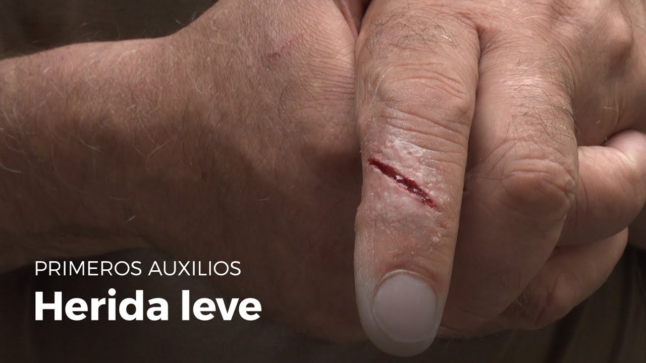 como curar un corte en el dedo con cuchillo