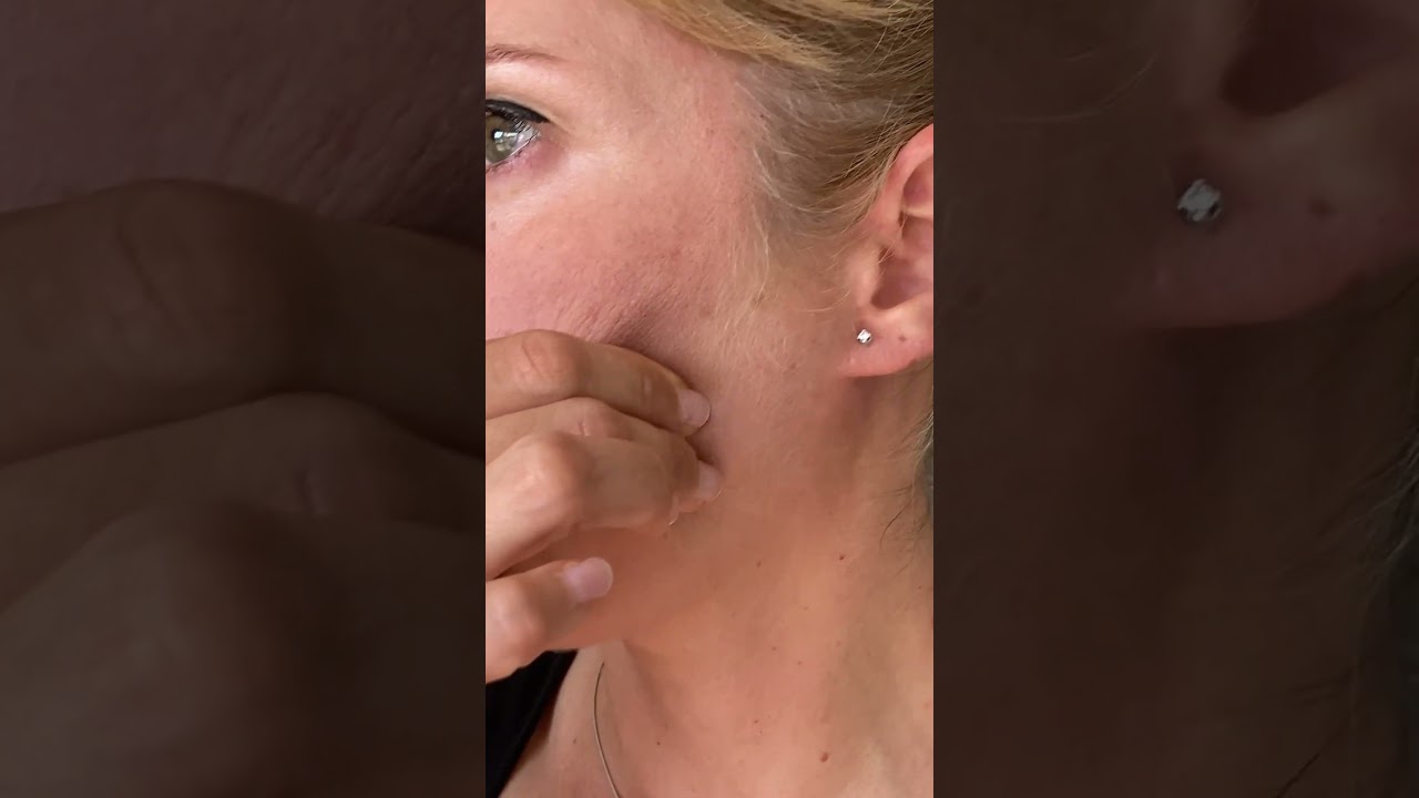 dolor en la oreja y mandibula