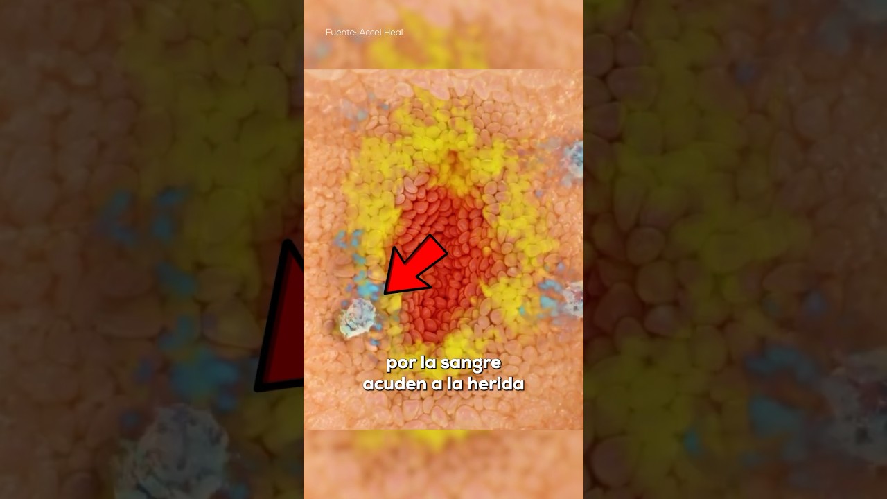 herida en el dedo que no se cura
