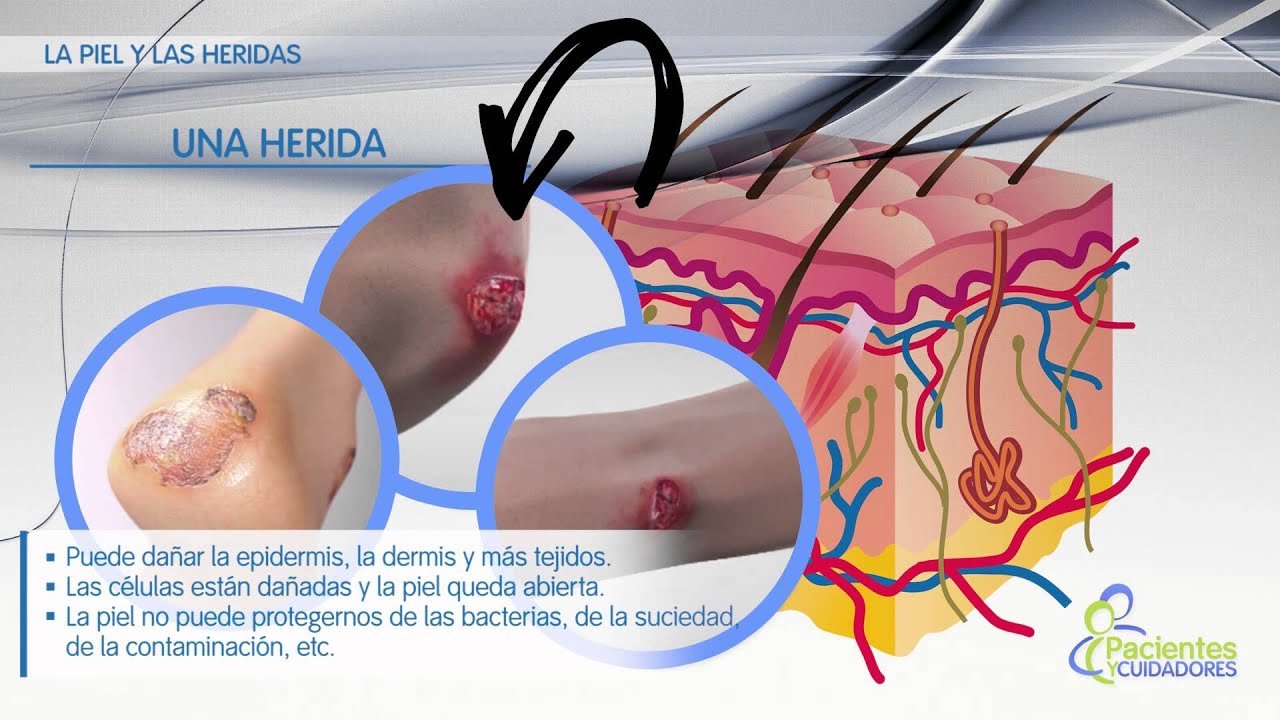 cuanto tarda una herida en cicatrizar