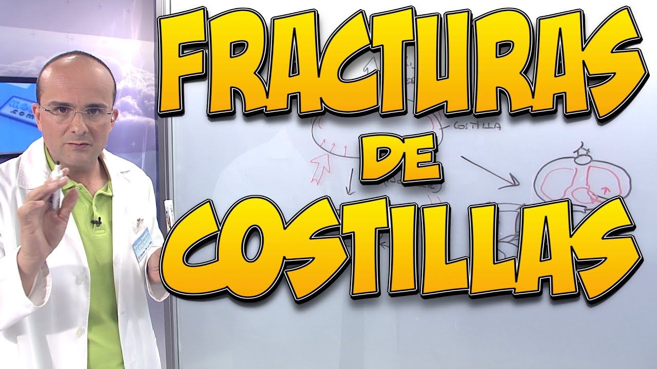 como tratar una fractura de costilla