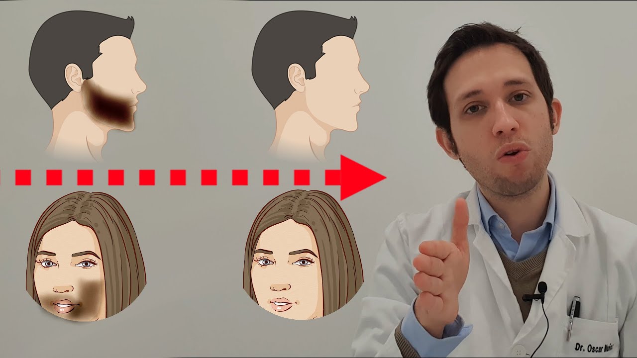 Cómo eliminar la pelusilla de la cara